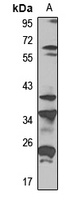 SPEM1 Antibody