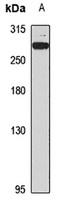 Spatacsin Rabbit Polyclonal Antibody