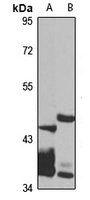 SPOP Rabbit Polyclonal Antibody