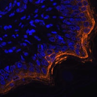 Anti-SPRR1A Antibody