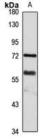 SPRTN Antibody