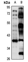 SPRY2 Antibody