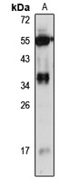 Sprouty 3 Rabbit Polyclonal Antibody