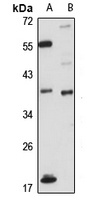 SPRY4 Antibody