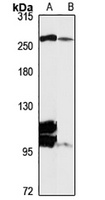 Spectrin beta Rabbit Polyclonal Antibody