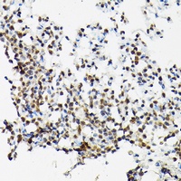 SC35 antibody