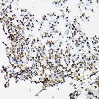 Anti-SC35 Antibody