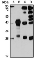 Sarcospan Rabbit Polyclonal Antibody