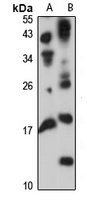 TRAP-delta Rabbit Polyclonal Antibody