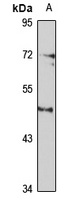 SSTR5 Antibody