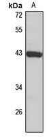 ST8SIA1 Antibody