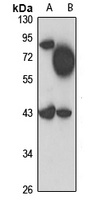 STK32A Rabbit Polyclonal Antibody
