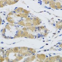 Anti-STK4 Antibody