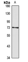 SPNR Rabbit Polyclonal Antibody