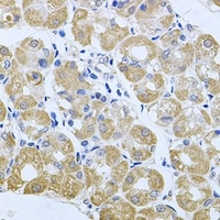 Anti-Striatin-3 Antibody