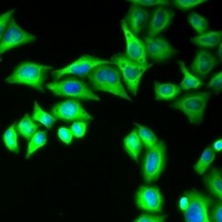 Anti-Striatin-3 Antibody