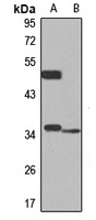 Syntaxin-11 Rabbit Polyclonal Antibody