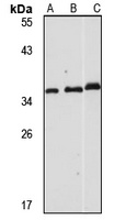 Syntaxin 6 Rabbit Polyclonal Antibody