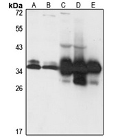 SUCLG1 Antibody