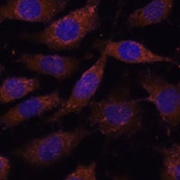 SUCLG1 antibody