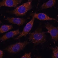 Anti-SUCLG1 Antibody