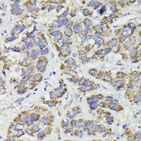 Anti-SUCLG2 Antibody