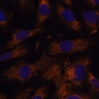 Anti-SUCLG2 Antibody
