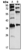 SULT1C4 Rabbit Polyclonal Antibody
