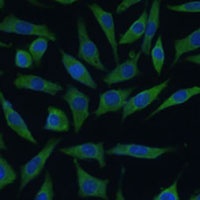 Anti-SUMF2 Antibody