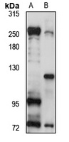 SPT6 Rabbit Polyclonal Antibody