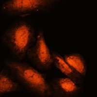 SPT6 Rabbit Polyclonal Antibody