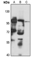 SUV420H1 Rabbit Polyclonal Antibody