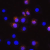 Anti-SWAP-70 Antibody