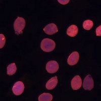 Anti-TADA3L Antibody