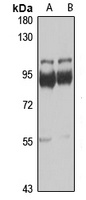 ThrRS Rabbit Polyclonal Antibody