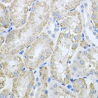 ThrRS Rabbit Polyclonal Antibody