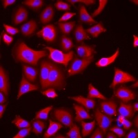 ThrRS Rabbit Polyclonal Antibody