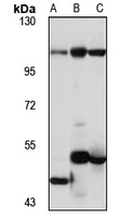 TARSL2 Rabbit Polyclonal Antibody