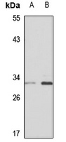 TATDN1 Rabbit Polyclonal Antibody