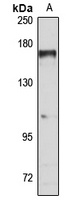TBC1D1 Antibody