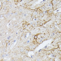 Anti-TBCA Antibody