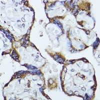 CKAP1 Antibody