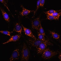 Anti-TBCC Antibody
