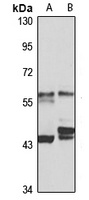 TBCE Rabbit Polyclonal Antibody