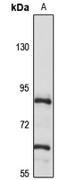 TBK1 Rabbit Polyclonal Antibody
