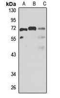 TBL1XR1 Antibody