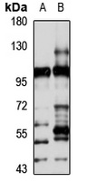 TBL3 Rabbit Polyclonal Antibody