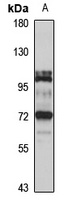 TBX2 Rabbit Polyclonal Antibody