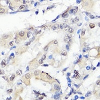 Anti-TBX20 Antibody