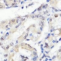 TBX20 antibody